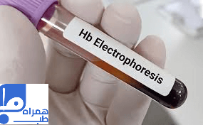 آزمایش پروتئین الکتروفورز